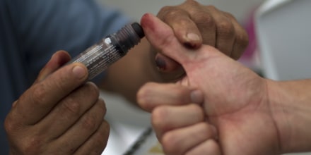 A voter has her right thumb stained with