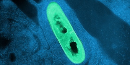 HeadlineImage