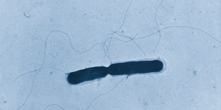 HeadlineImage