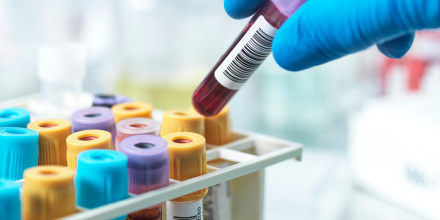 Hand of pathologist holding a blood sample in test tube at laboratory