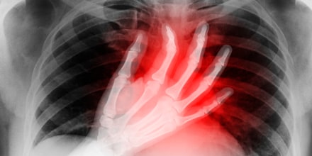 X-ray of hand on heart