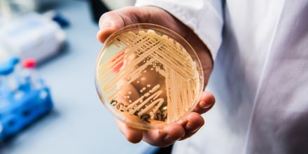 A hand holding a petri dish with yeast inside, thick beige lines are scattered on top of a clear dish