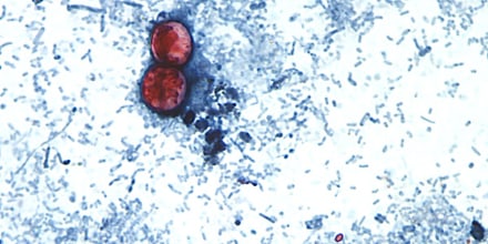 EE.UU. reporta las primeras dos muertes por el brote de ciclosporiasis que enferma a miles