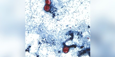 Investigan a un proveedor de lechuga iceberg por brote de ciclosporiasis