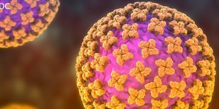 "No es normal que ocurra en cruceros" un brote de hantavirus. Vea cómo detectar la enfermedad