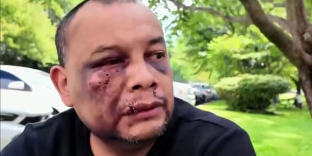 Hospitalizan otra vez a José Mejía, el inmigrante golpeado violentamente por agentes migratorios