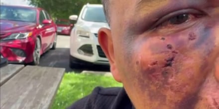 “Por los golpes que tuve en la cabeza, me cuesta entender”: inmigrante relata detención de ICE