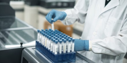 Trump dice estar "preocupado" por el brote de ébola. Identifican a doctor de EE.UU. enfermo