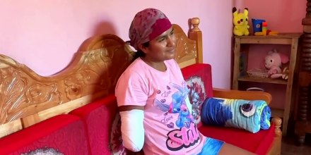 Habla la mujer que perdió los antebrazos por el ataque a machetazos de su expareja