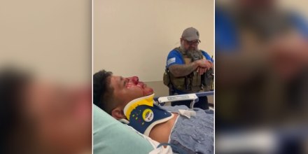 Inmigrante guatemalteco denuncia lesiones tras operativo de ICE