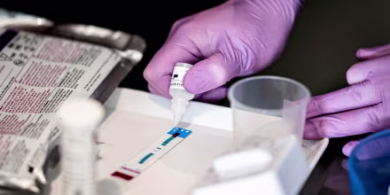 A rapid test at the sexual health clinic.