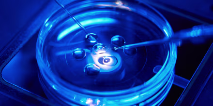 Closeup of intracytoplasmic sperm injection being performed in Petri dish