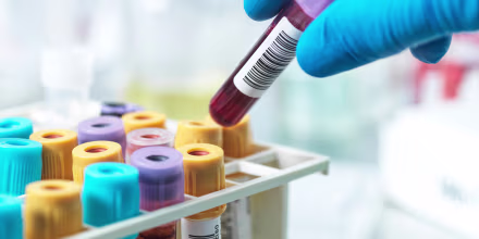 Hand of pathologist holding a blood sample in test tube at laboratory