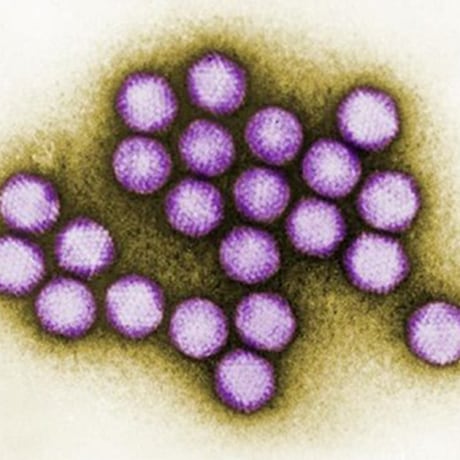 Image: Adenovirus transmission electron micrograph.