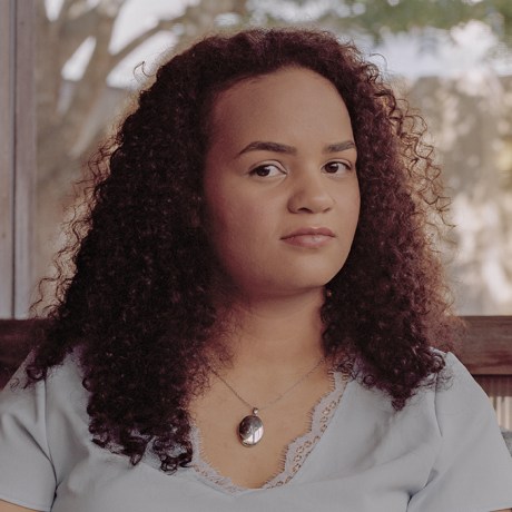 A split composite image of Nala White seated on a couch, left, and her lifting up her shirt to reveal scars on her back next to a phone showing a photo of said scar