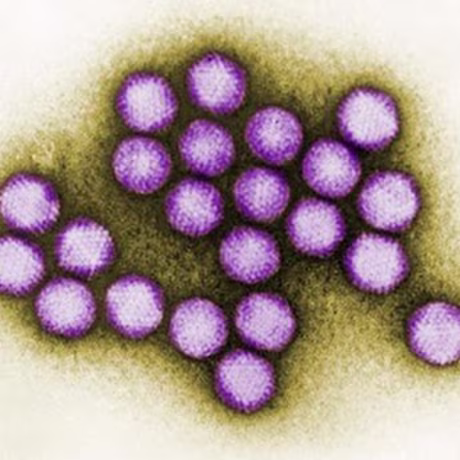 Image: Adenovirus transmission electron micrograph.