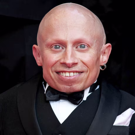 Image: FILE: Verne Troyer Dies At 49