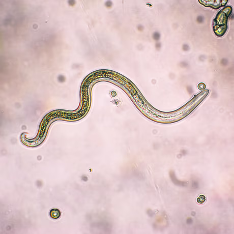 Image: A roundworm that causes Toxocariasis under a microscope.