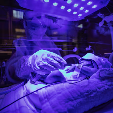 Treatment of children with Covid-19 at UHS Training and Research Hospital