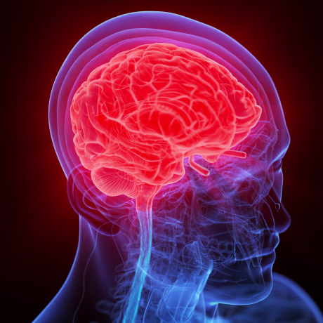 alzheimers symptoms