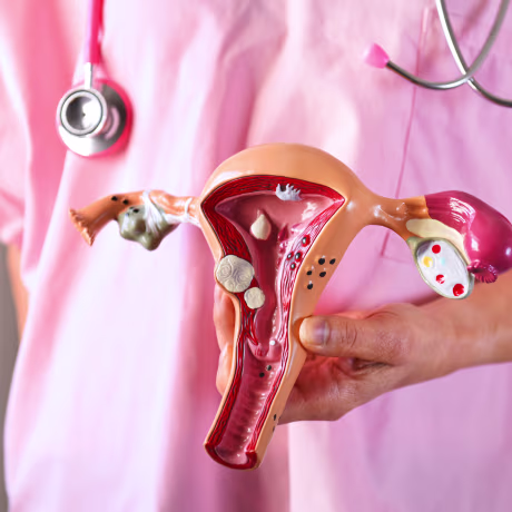 Surgeon holding Common pathologies anatomical model