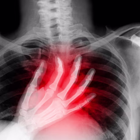X-ray of hand on heart