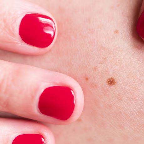 Close-up of woman wearing red nail polish touching skin with freckle