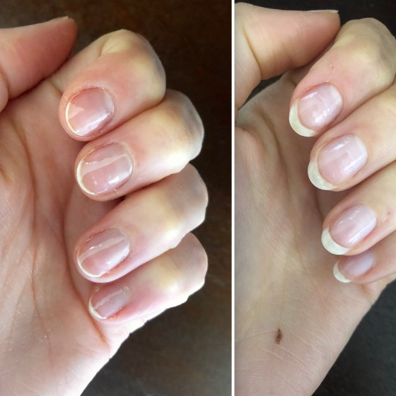 NailTek Nail Recovery Kit, Cuticle Oil, Strengthener, Ridge Filler - restore damaged nails in 3 steps