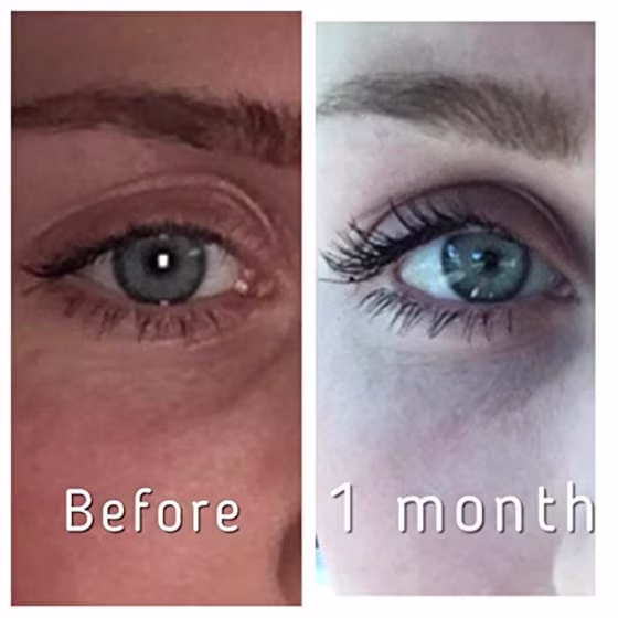 Pronexa Hairgenics Lavish Lash Serum