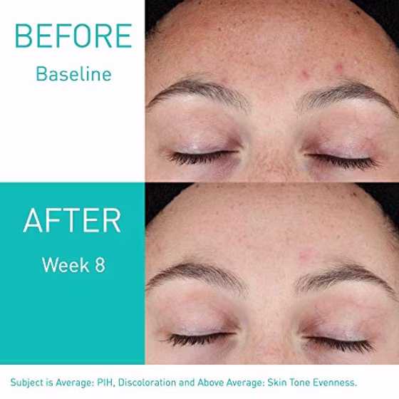 Resurfacing Retinol Serum