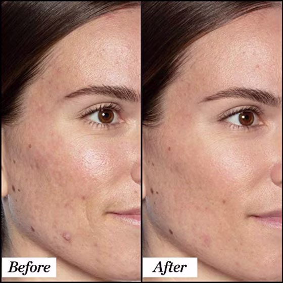 Sunday Riley Good Genes All-in-One Lactic Acid Treatment