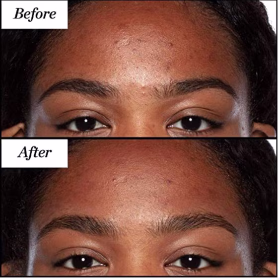Sunday Riley Good Genes All-in-One Lactic Acid Treatment
