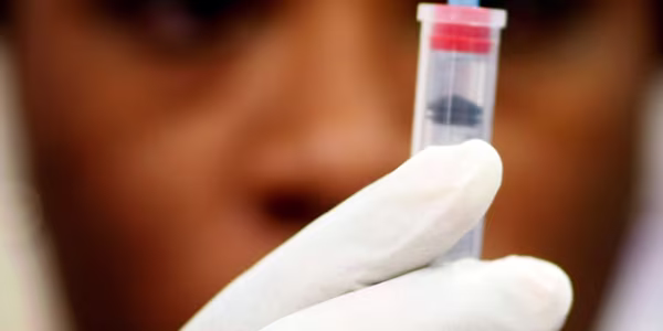 Swine flu worries world