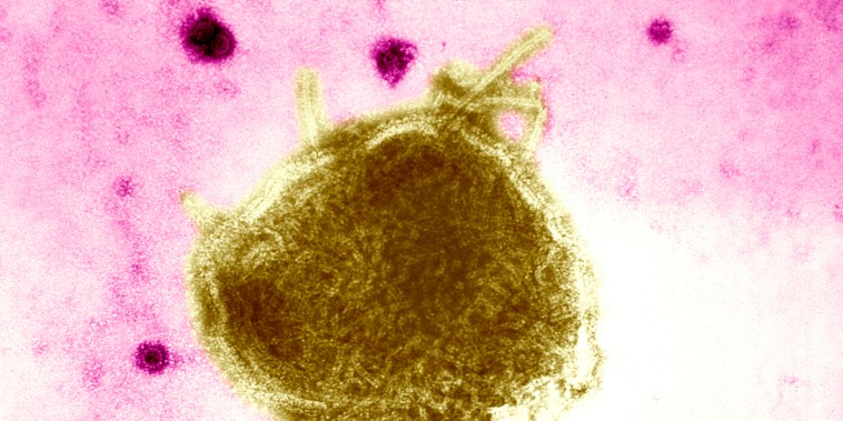 Paramyxoviridae Virus