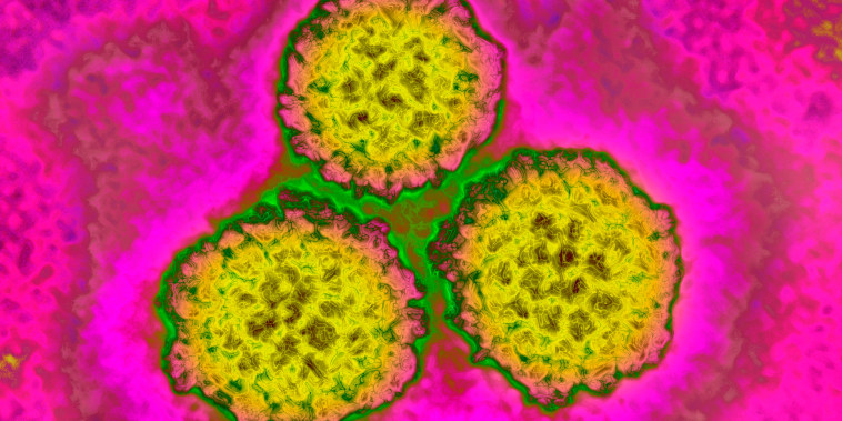 Image: A strain of HPV taken with a transmission electron microsope.