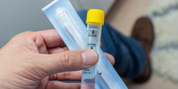 Man holding a sample collection tube for Chlamydia testing