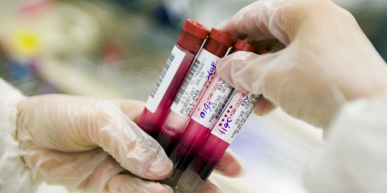 Blood samples in a laboratory.