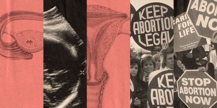Photo illustration of a woman's reproductive system diagram, a sonogram of a uterus, abortion rights and anti-abortion protesters.