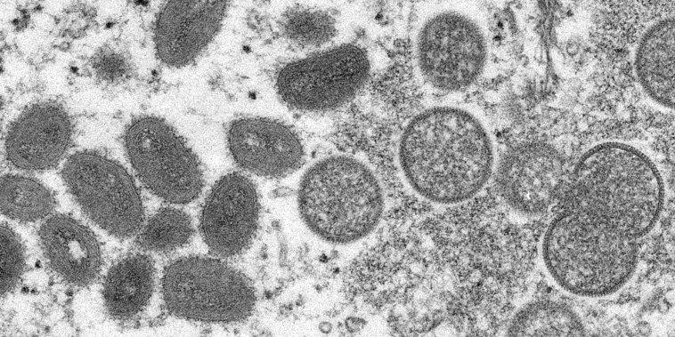 This 2003 electron microscope image made available by the Centers for Disease Control and Prevention shows mature, oval-shaped monkeypox virions, left, and spherical immature virions, right, obtained from a sample of human skin associated with the 2003 prairie dog outbreak