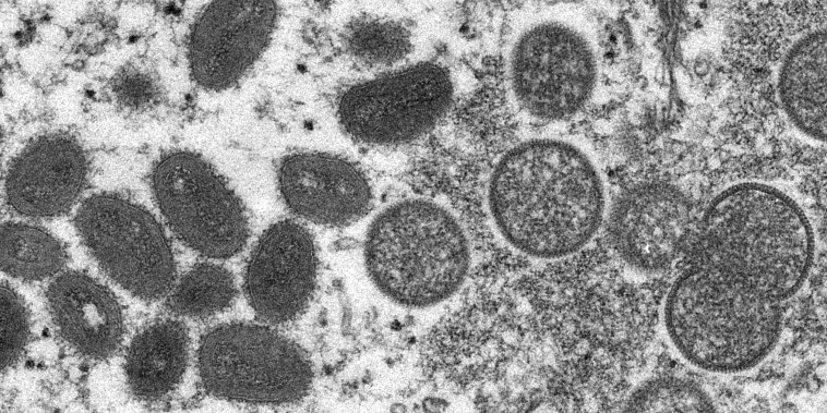 An electron microscope image of monkeypox virions, left, and spherical immature virions, right, obtained from a sample of human skin.