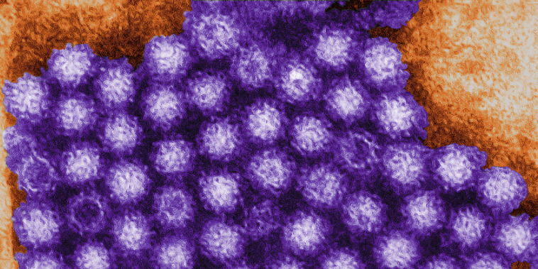 Image: Norovirus
