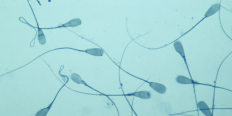 Espermatozoides, amplificados 250 veces en un microscopio.