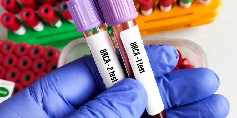 Blood sample for BRCA Genetic test, known as mutations, in genes called BRCA1 and BRCA2.