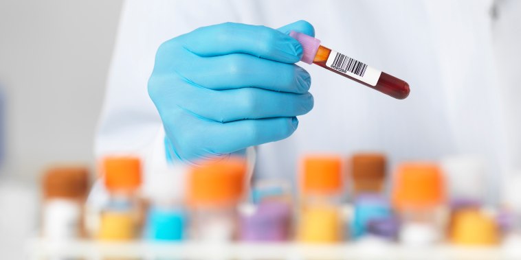 Close up of scientists hands selecting a blood sample for medical testing