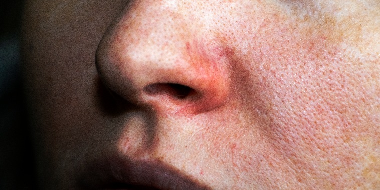 Nose of a young woman.