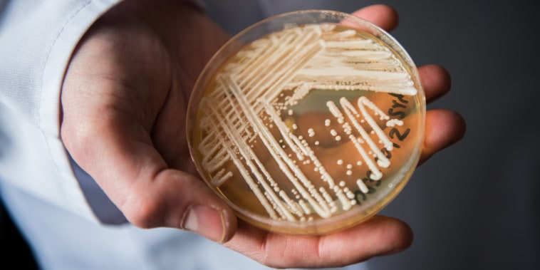 Petri dish of candida auris in a laboratory in Wuerzburg, Germany