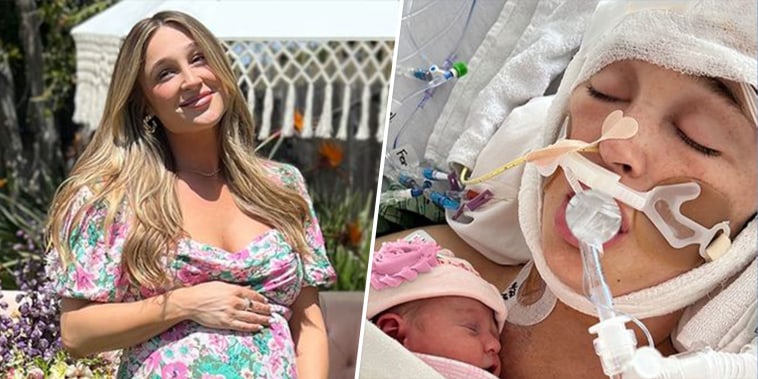 Pregnant influencer suffered aneurysm rupture 1 week before due date, in medically induced coma