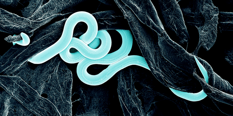 This newly discovered nematode is believed to cause beech leaf disease.