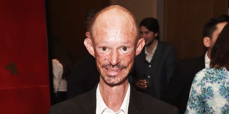‘Game of Thrones’ actor Darren Kent has died, talent agency says
