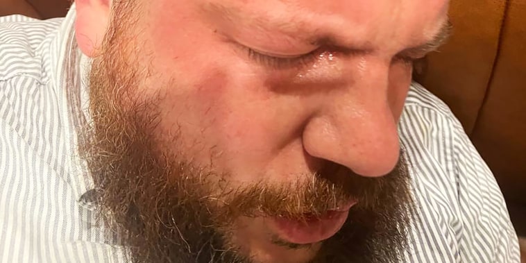Navalny ally attacked in Lithuania